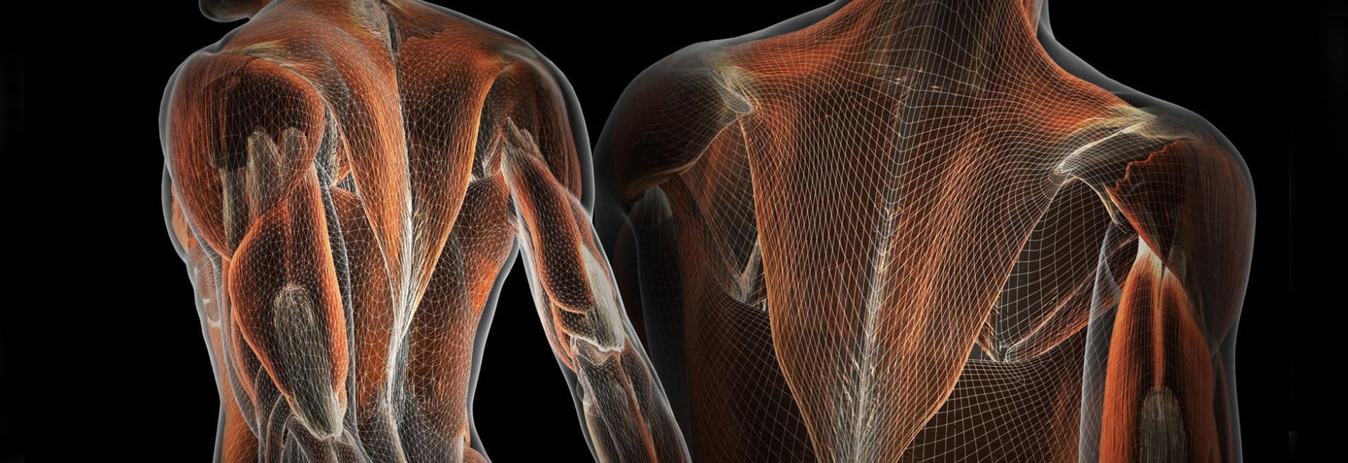 A Consumer Reports survey of 3,562 back-pain sufferers.